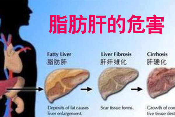 脂肪肝發(fā)展變化過(guò)程