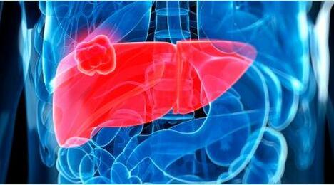 為什么養(yǎng)肝需要補硒？生活中如何保肝護肝？