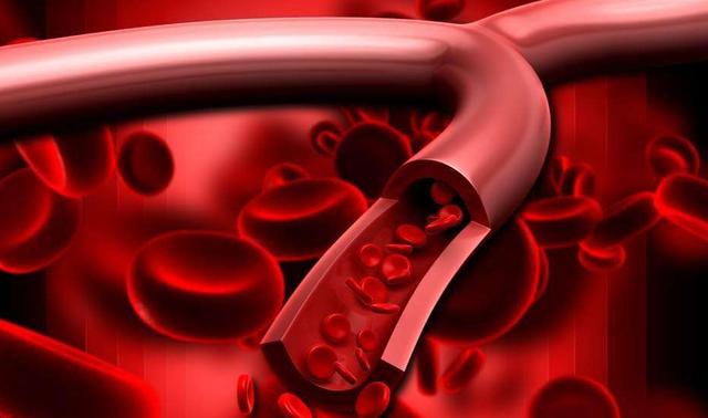 老人血脂稠危害大，多補(bǔ)硒有助降血脂