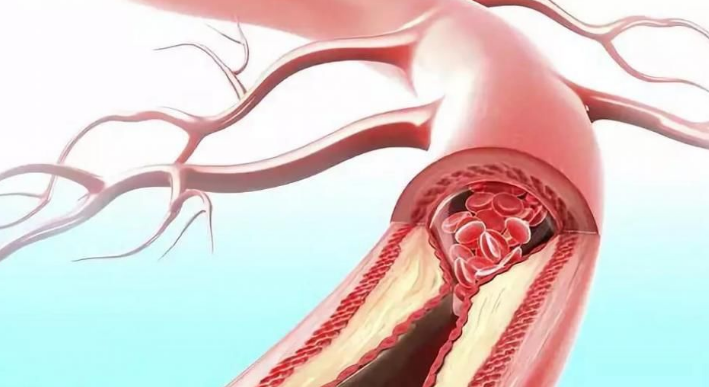 步入中年易血液粘稠，警惕這3個(gè)癥狀外可多補(bǔ)硒