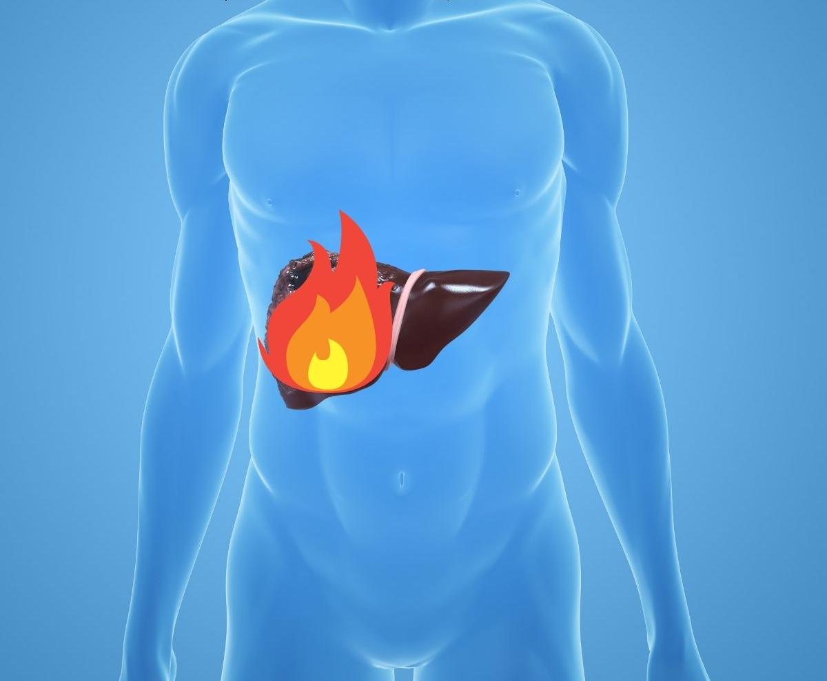 肝火旺怎么辦？